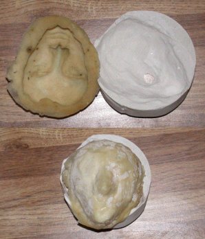 Head mold (both sides) and support